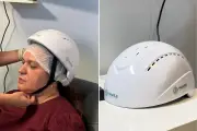 Capacete com luz infravermelha da Santos Tecnologia trata transtornos mentais