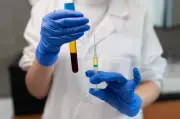 CFM libera plasma rico em plaquetas para quatro condições osteomusculares