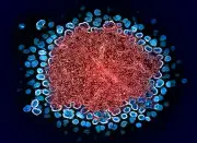Dois novos casos de cura do HIV após transplante de células-tronco