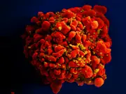 Dois novos casos de possível cura do HIV são anunciados