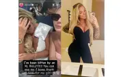 Ex-BBB Aisleyne Horgan Wallace sofre ataques após ser mordida por cão