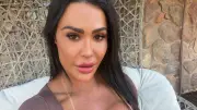 Gracyanne Barbosa revela procedimentos íntimos; especialistas explicam
