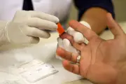 HIV: queda global de 43% contrasta com aumento de 20% no Brasil