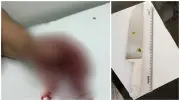 Homem decepa polegar da esposa com faca e responde em liberdade