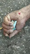 Homem morre após cair em calçada rebaixada em João Pinheiro, MG