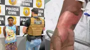 Homem preso por atear fogo na ex-companheira no MA