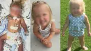 Menina de 18 meses perde pernas após choque séptico nos EUA