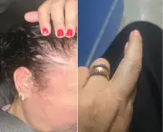 Mulher denuncia genro policial militar por agressão em Iguaba Grande