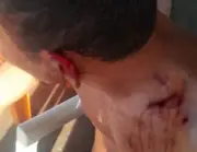 Mulher morde e arranca parte da orelha do marido em bar em Boa Vista