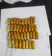 Preso após cirurgia para retirar 38 cápsulas de cocaína do corpo em Natal