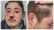 Professor espancado em metrô de SP alega homofobia e omissão