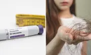 Queda de cabelo com canetas emagrecedoras: estudo explica e dá dicas