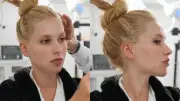 Virginia Fonseca faz rejuvenescimento facial com XERF; entenda técnica
