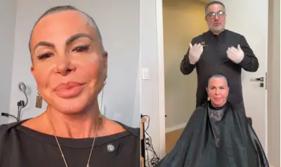 Gretchen raspa a cabeça ao vivo para transplante capilar e incentiva quem tem alopecia