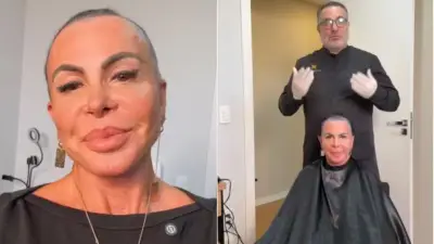 Gretchen raspa a cabeça e faz transplante capilar em Vitória