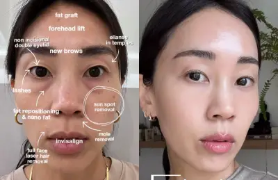Pele humana doada: o novo tratamento radical da K-beauty