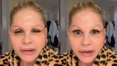 Recuperação de cirurgia facial: o que esperar após o procedimento