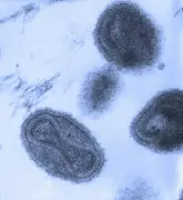 DNA de múmias chilenas revela chegada da varíola às Américas