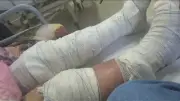 Idosa de 76 anos fica ferida após balão atingir casa em Nova Iguaçu