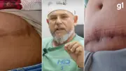 Justiça torna réu cirurgião plástico acusado de crimes contra pacientes no RS