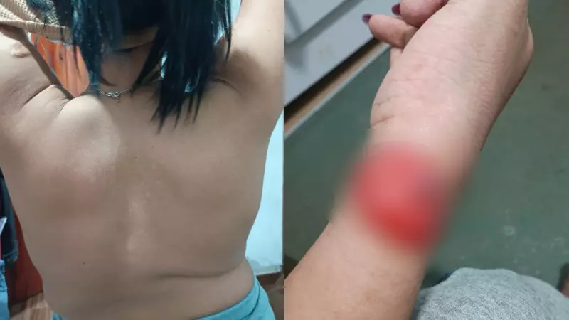 Adolescente com síndrome rara enfrenta desafios em único ambulatório do SUS no Brasil