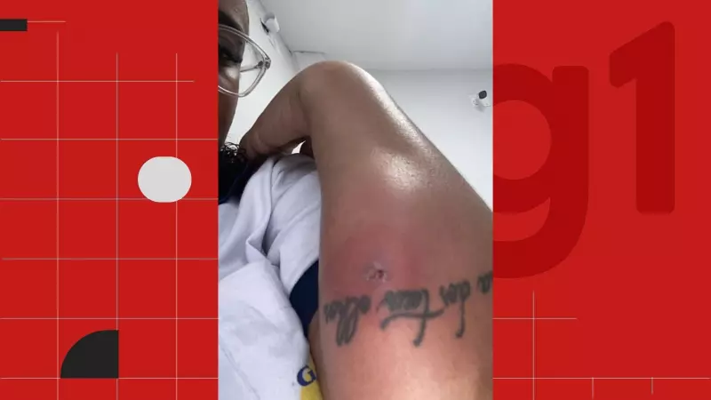 Ex-dançarina fica paraplégica após complicação rara causada por furúnculo no ES
