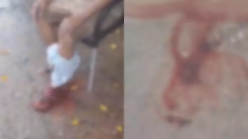 Idoso em situação de rua é atacado por Pitbull na Zona Oeste do Recife: veja detalhes