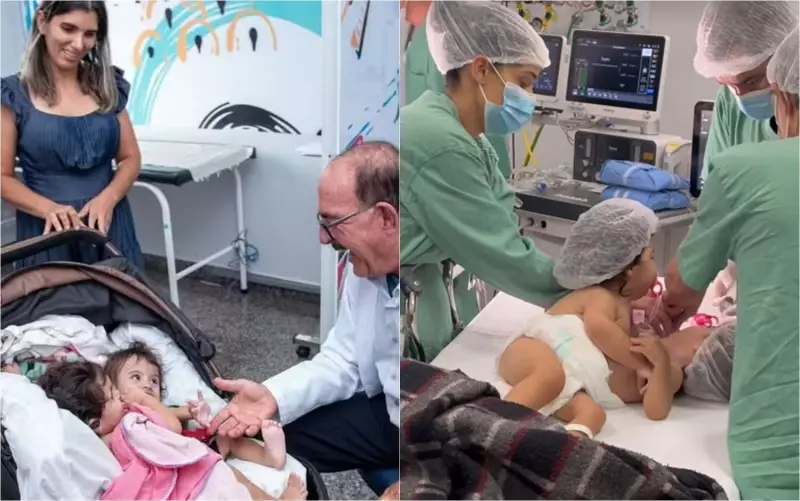 Irmã de siamesa que faleceu após cirurgia de separação está sedada e em estado grave, revela hospital
