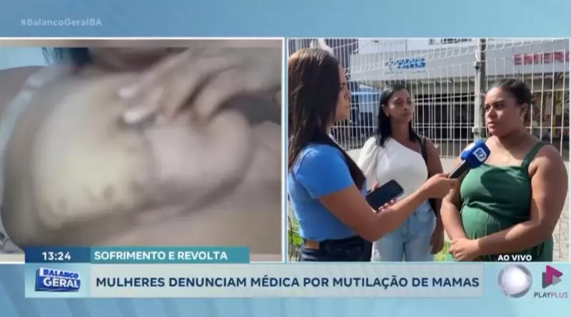 Médica é denunciada por mutilação de mamas na Bahia: vítimas relatam traumas