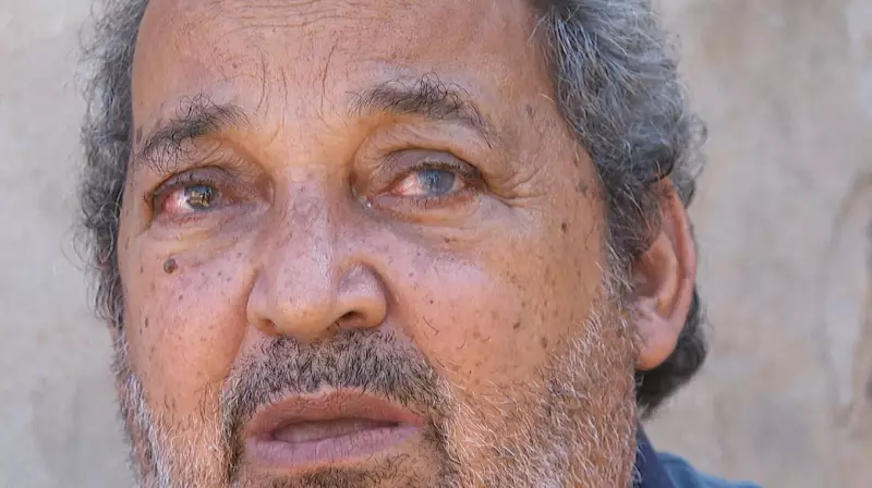 MP move ação de R$ 3 milhões após pacientes ficarem cegos em mutirão de catarata em Ribeirão Preto