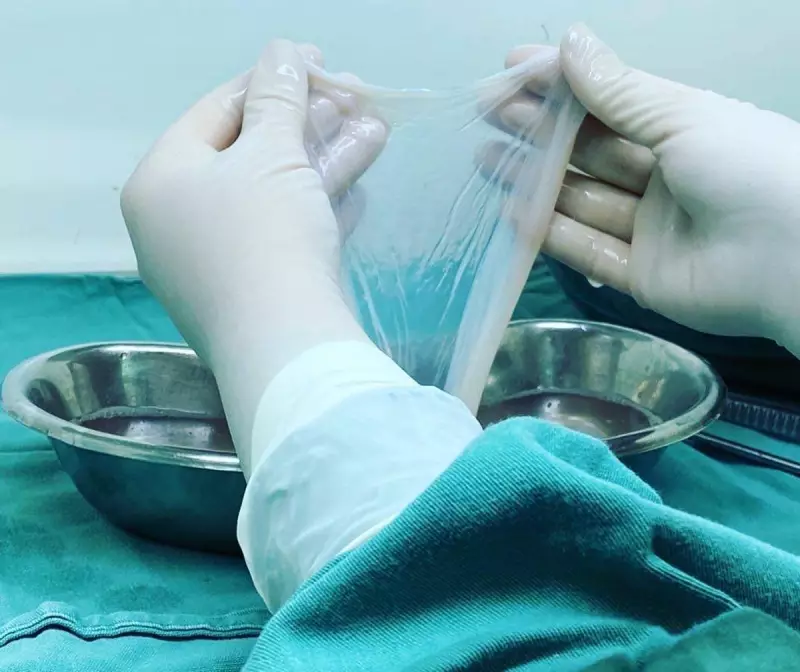 SUS adota tratamento inovador para queimaduras com membrana fetal – técnica salvou vítimas da Boate Kiss